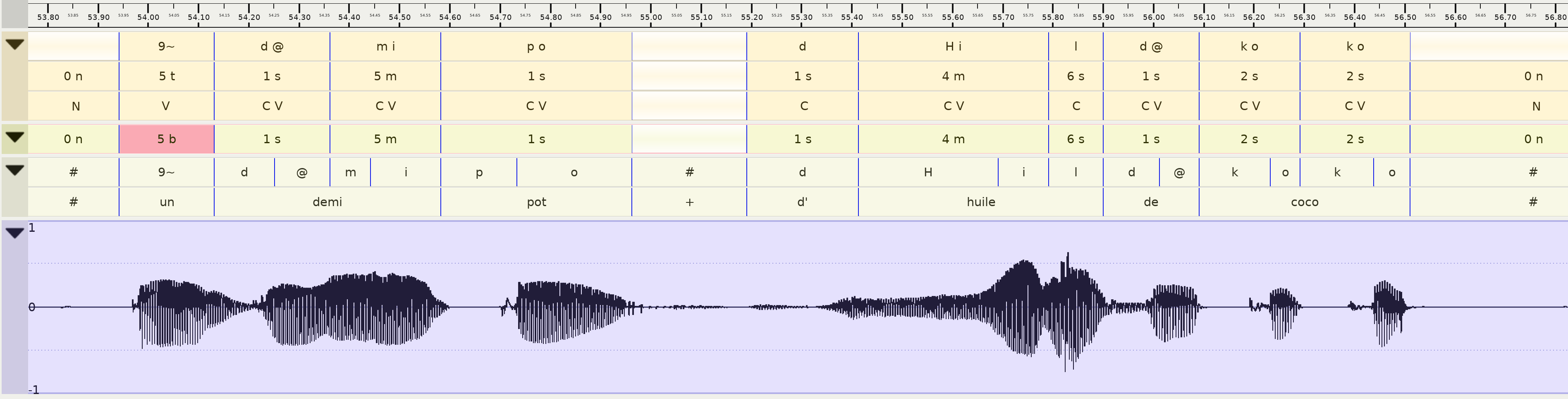 Annotations de l'audio